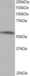 Antibody staining (0.5 ug/ml) of human muscle lysate (RIPA buffer, 35 ug total protein per lane). Primary incubated for 1 hour. Detected by Western blot of chemiluminescence.