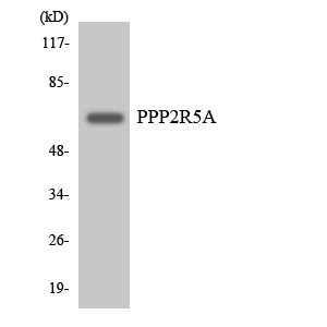 Western blot of the lysates from HeLa cells using PPP2R5A antibody.