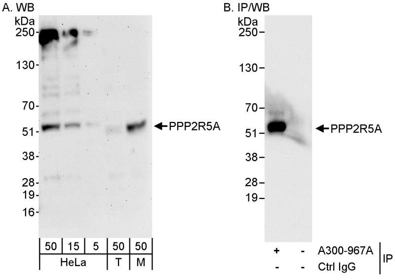 Detection of Human and Mouse PPP2R5A by WB (h&m) and Immunoprecipitation (h). Samples: Whole cell lysate from HeLa (5, 15 and 50 ug for WB; 1 mg for IP, 20% of IP loaded), 293T (T; 50 ug) and mouse NIH3T3 (M; 50 ug) cells. Antibodies: Affinity purified rabbit anti-PPP2R5A antibody used for WB at 0.04 ug/ml (A) and 0.1 ug/ml (B) and used for IP at 3 ug/mg lysate (B). Detection: Chemiluminescence with exposure times of 3 minutes (A) and 30 seconds (B).