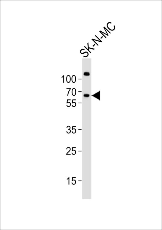 Western blot of lysate from SK-N-MC cell line with PPP2R5B Antibody. Antibody was diluted at 1:1000. A goat anti-rabbit IgG H&L (HRP) at 1:10000 dilution was used as the secondary antibody. Lysate at 20 ug.
