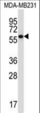 PPP2R5C Antibody western blot of MDA-MB231 cell line lysates (35 ug/lane). The PPP2R5C antibody detected the PPP2R5C protein (arrow).