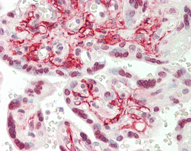 Human Placenta: Formalin-Fixed, Paraffin-Embedded (FFPE)