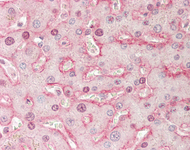Human Liver: Formalin-Fixed, Paraffin-Embedded (FFPE)