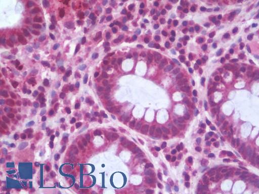 Anti-PPP2R5D antibody IHC staining of human colon. Immunohistochemistry of formalin-fixed, paraffin-embedded tissue after heat-induced antigen retrieval. Antibody LS-B9873 concentration 10 ug/ml.