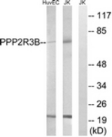Western blot of extracts from Jurkat/HUVEC cells, using PPP2R5D Antibody. The lane on the right is treated with the synthesized peptide.