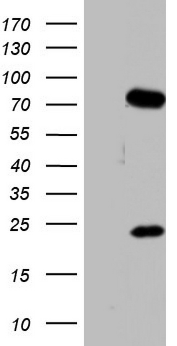 HEK293T cells were transfected with the pCMV6-ENTRY control (Left lane) or pCMV6-ENTRY PPP2R5D (Right lane) cDNA for 48 hrs and lysed. Equivalent amounts of cell lysates (5 ug per lane) were separated by SDS-PAGE and immunoblotted with anti-PPP2R5D.
