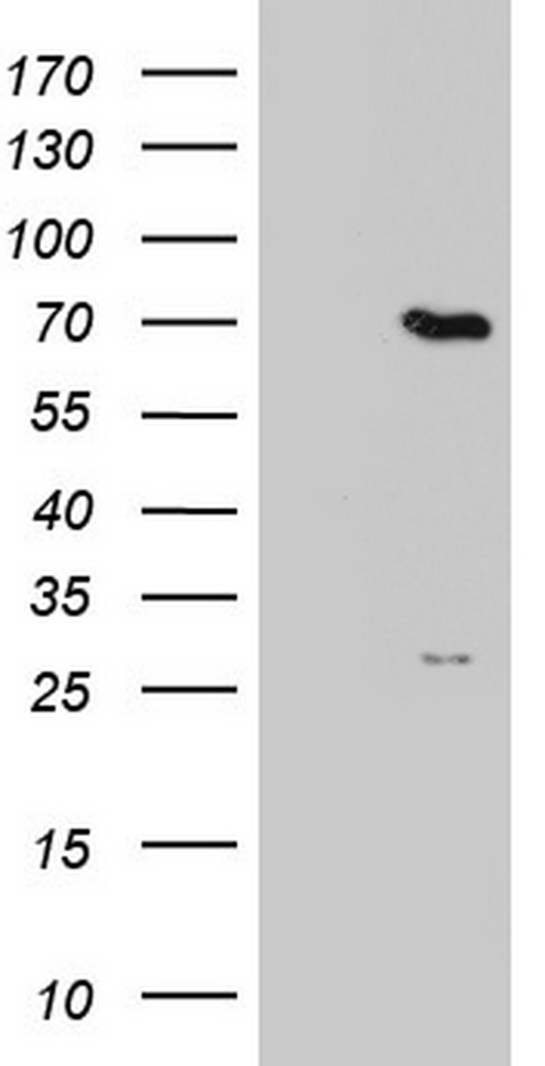 HEK293T cells were transfected with the pCMV6-ENTRY control (Left lane) or pCMV6-ENTRY PPP2R5D (Right lane) cDNA for 48 hrs and lysed. Equivalent amounts of cell lysates (5 ug per lane) were separated by SDS-PAGE and immunoblotted with anti-PPP2R5D.