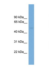 PPP2R5E antibody LS-C135393 Western blot of ACHN Cell lysate. Antibody concentration 1 ug/ml.