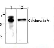 Western blot of CCN1 / Calcineurin A antibody LS-C48178.