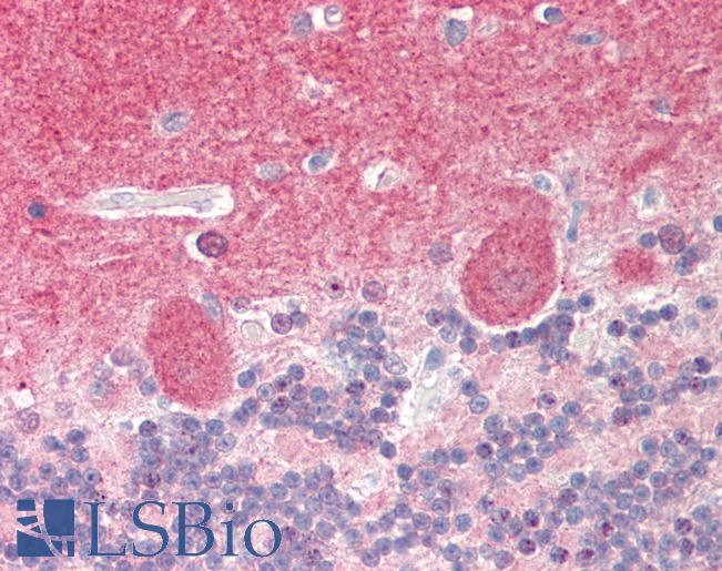 Human Brain, Cerebellum: Formalin-Fixed, Paraffin-Embedded (FFPE)