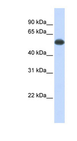 PPP3CA / Calcineurin A antibody western blot of Fetal Muscle lysate.