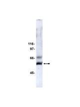 WB: Rat brain preparation was probed with Anti-Calcineurin/PP2B A (2g/ml).