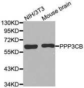 Western blot analysis of extracts of various cell lines, using PPP3CB antibody.