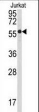 Western blot of anti-PPP3CB Antibody in Jurkat cell line lysates (35 ug/lane). PPP3CB(arrow) was detected using the purified antibody.