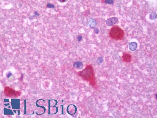 Anti-PPP3CB antibody IHC staining of human brain, cortex. Immunohistochemistry of formalin-fixed, paraffin-embedded tissue after heat-induced antigen retrieval. Antibody LS-B10793 concentration 7.5 ug/ml.