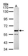 Sample (30 ug of whole cell lysate). A: Molt-4 . 7.5% SDS PAGE. PPP3CB antibody diluted at 1:5000.