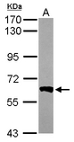 Sample (50 ug of whole cell lysate). A: Mouse brain. 7.5% SDS PAGE. PPP3CB antibody diluted at 1:1000.