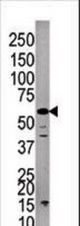 Western blot of anti-PPP3CC antibody in A375cell line lysate.PPP3CC(arrow) was detected using the purified antibody.