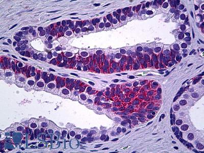Anti-PPP3CC antibody IHC of human prostate. Immunohistochemistry of formalin-fixed, paraffin-embedded tissue after heat-induced antigen retrieval. Antibody LS-B5675 concentration 5 ug/ml.