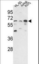 Western blot of hPPP3CC-E33 in HL-60, Jurkat, A375 cell line lysates (35 ug/lane). PPP3CC (arrow) was detected using the purified antibody.