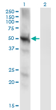 Western Blot analysis of PPP3CC expression in transfected 293T cell line by PPP3CC monoclonal antibody (M01), clone 4D1.Lane 1: PPP3CC transfected lysate (Predicted MW: 58.1 KDa).Lane 2: Non-transfected lysate.