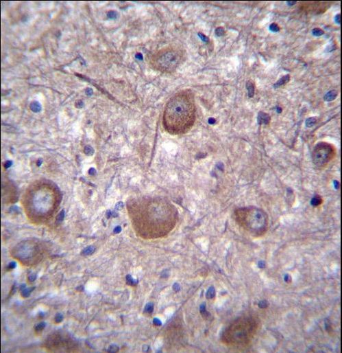 PPP3CC Antibody immunohistochemistry of formalin-fixed and paraffin-embedded human brain tissue followed by peroxidase-conjugated secondary antibody and DAB staining.