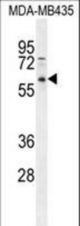 PPP3CC Antibody western blot of MDA-MB435 cell line lysates (35 ug/lane). The PPP3CC antibody detected the PPP3CC protein (arrow).