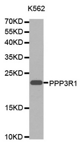 Western blot analysis of extracts of K-562 cells lines, using PPP3R1 antibody.