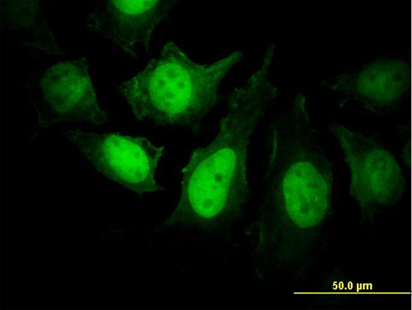 Immunofluorescence of monoclonal antibody to PPP3R1 on HeLa cell. [antibody concentration 25 ug/ml]