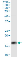 PPP3R1 monoclonal antibody (M01), clone 4E1. Western Blot analysis of PPP3R1 expression in rat brain.