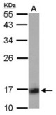 Sample (30 ug of whole cell lysate) A: IMR32 12% SDS PAGE PPP3R1 antibody diluted at 1:1000