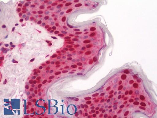Human Skin: Formalin-Fixed, Paraffin-Embedded (FFPE)