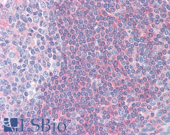 Anti-PPP3R1 antibody IHC of human tonsil. Immunohistochemistry of formalin-fixed, paraffin-embedded tissue after heat-induced antigen retrieval. Antibody LS-B2813 concentration 5 ug/ml.