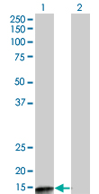 Western Blot analysis of PPP3R2 expression in transfected 293T cell line by PPP3R2 monoclonal antibody (M07), clone 5D9.Lane 1: PPP3R2 transfected lysate(19.9 KDa).Lane 2: Non-transfected lysate.