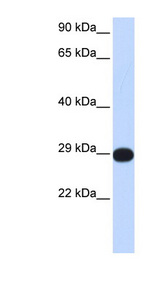PPP4C antibody LS-C112208 Western blot of Fetal Muscle lysate.