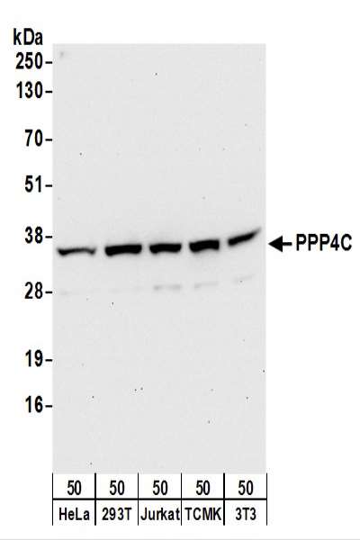 Detection of Human and Mouse PPP4C by Western Blot. Samples: Whole cell lysate (50 ug) from HeLa, 293T, Jurkat, mouse TCMK-1, and mouse NIH3T3 cells. Antibodies: Affinity purified rabbit anti-PPP4C antibody used for WB at 0.1 ug/ml. Detection: Chemiluminescence with an exposure time of 30 seconds.
