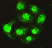 Immunocytochemistry of HeLa cells using anti- Protein Phosphatase 4C antibody diluted 1:200.