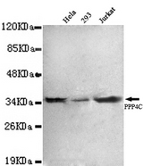 PPP4C antibody at 1:1000 dilution Lane1:HeLa whole cell lysate 40 ug/Lane Lane2: 293 whole cell lysate 40 ug/Lane Lane3: Jurkat whole cell lysate 40 ug/Lane.