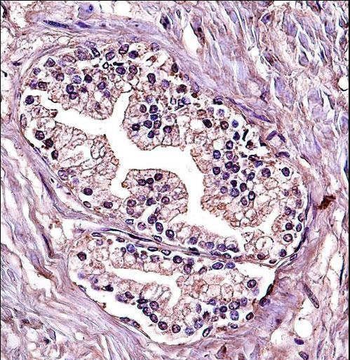 PPP4C Antibody immunohistochemistry of formalin-fixed and paraffin-embedded human prostate tissue followed by peroxidase-conjugated secondary antibody and DAB staining.