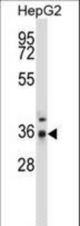 PPP4C Antibody western blot of HepG2 cell line lysates (35 ug/lane). The PPP4C antibody detected the PPP4C protein (arrow).