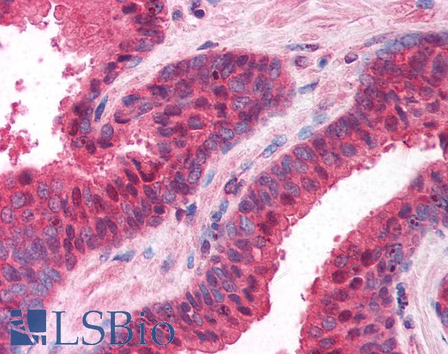 Anti-PPP4C antibody IHC of human prostate. Immunohistochemistry of formalin-fixed, paraffin-embedded tissue after heat-induced antigen retrieval. Antibody LS-B752 concentration 10 ug/ml.