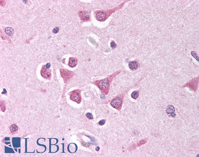 Anti-PPP4C antibody IHC of human brain, cortex. Immunohistochemistry of formalin-fixed, paraffin-embedded tissue after heat-induced antigen retrieval. Antibody LS-B752 concentration 10 ug/ml.