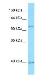 PPP4R1 / PP4R1 antibody Western Blot of HT1080 cell lysate.