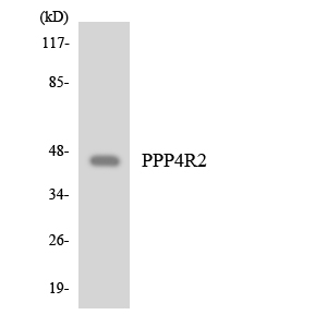 Western blot of the lysates from COLO205 cells using PPP4R2 antibody.