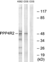 Western blot of extracts from K562/COS7 cells, using PPP4R2 Antibody. The lane on the right is treated with the synthesized peptide.