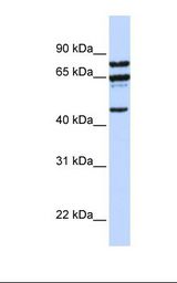 Jurkat cell lysate. Antibody concentration: 1.0 ug/ml. Gel concentration: 12%.