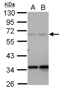 Sample (30 ug of whole cell lysate) A: A431 B: Jurkat 10% SDS PAGE PPP4R2 antibody diluted at 1:1000