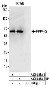 Detection of Human PPP4R2 by Western Blot of Immunoprecipitates. Samples: Whole cell lysate (1 mg for IP; 20% of IP loaded) prepared using NETN buffer from HeLa cells. Antibodies: Affinity purified rabbit anti-PPP4R2 antibody used for IP at 6 ug per reaction. PPP4R2 was also immunoprecipitated by a previous lot of this antibody. For blotting immunoprecipitated PPP4R2 , was used at 1 ug/ml. Detection: Chemiluminescence with an exposure time of 30 seconds.