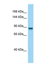 PPP4R4 antibody LS-C146523 Western blot of Mouse Liver lysate. Antibody concentration 1 ug/ml.