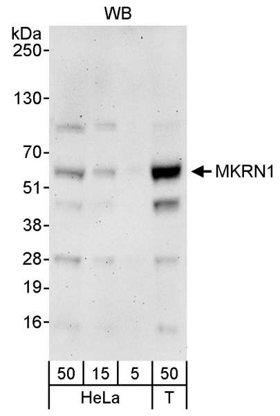 Detection of Human MKRN1 by Western Blot. Samples: Whole cell lysate from HeLa (5, 15 and 50 ug) and 293T (T; 50 ug) cells. Antibody: Affinity purified rabbit anti-MKRN1 antibody used for WB at 0.1 ug/ml. Detection: Chemiluminescence with an exposure time of 3 minutes.